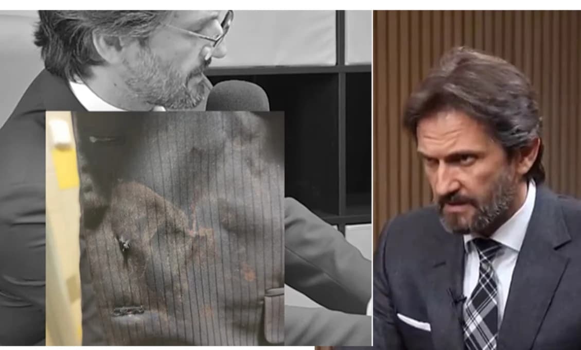 Prestrieľané sako a krvavá košeľa - Kaliňák ukázal doteraz nezverejnené fotografie (VIDEO)