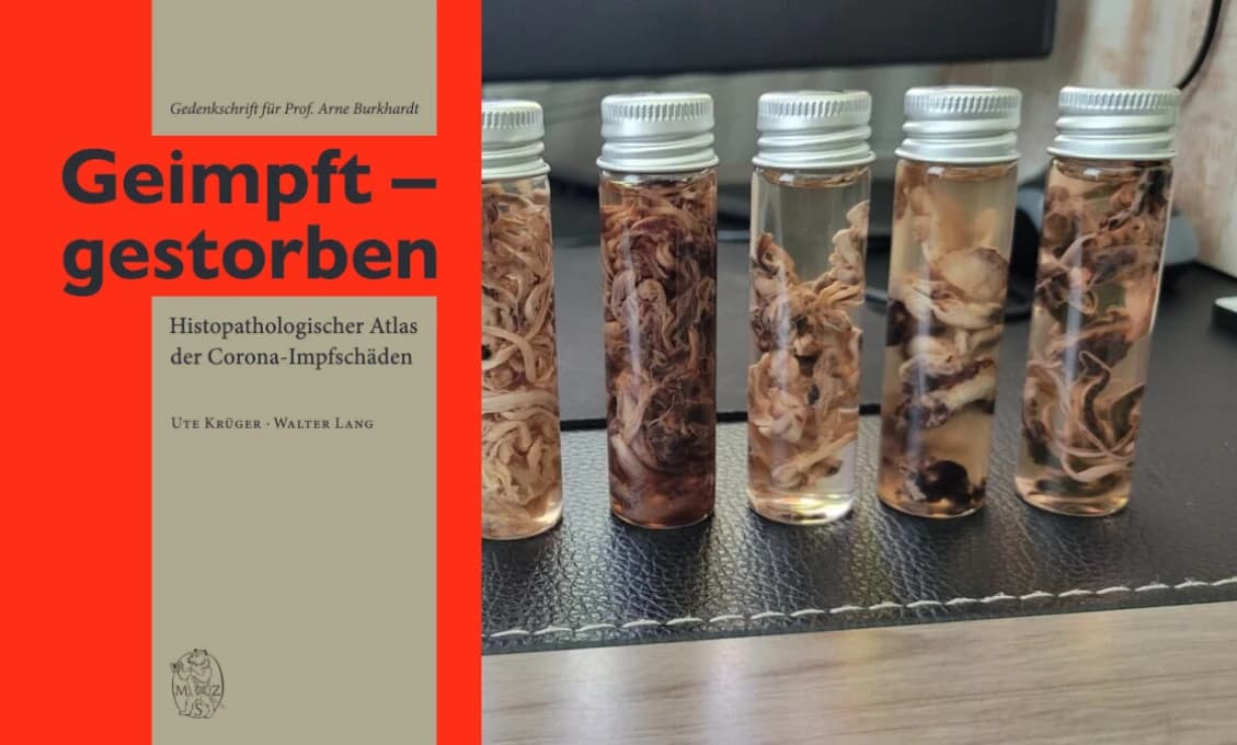 Patológovia o smrtiacich následkoch mRNA očkovania proti COVID-19