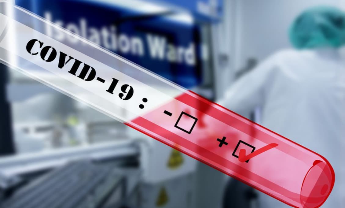Štátny ústav pre kontrolu liečiv odhalil falošné testy na COVID-19