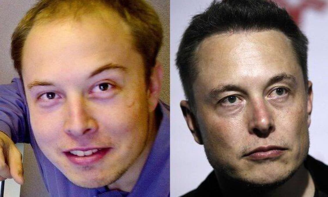 Elon Musk, ako ho nepoznáte: Než si nastrelil vlasy, bol z neho plešatý študentík