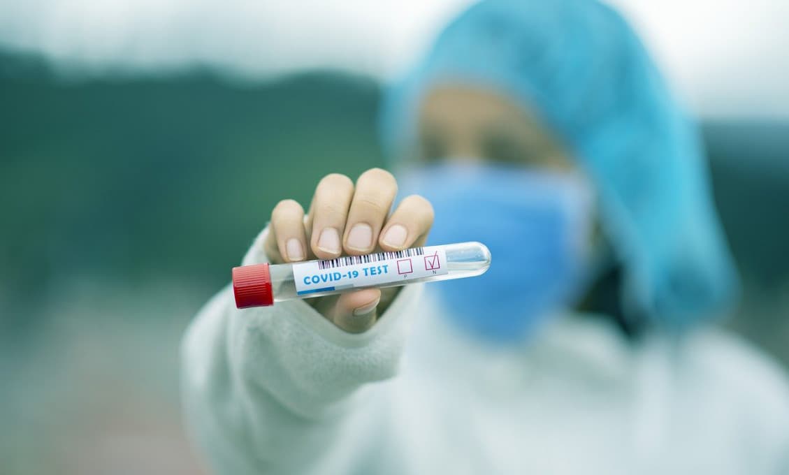 Otestujú nás všetkých? Vláda plánuje dať na zisťovanie protilátok milióny eur
