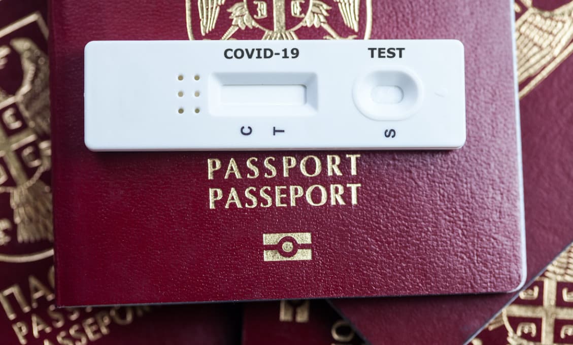 WHO nechce "imunitné pasy", ale rozmýšľa o certifikátoch