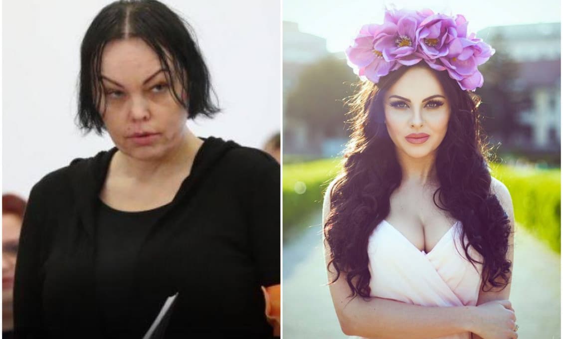 Bývalá farmárka Hrmová doplatila na experimenty s vlasmi: Preboha, vyzerá ako Alena Zsuzsuvá! (FOTO)