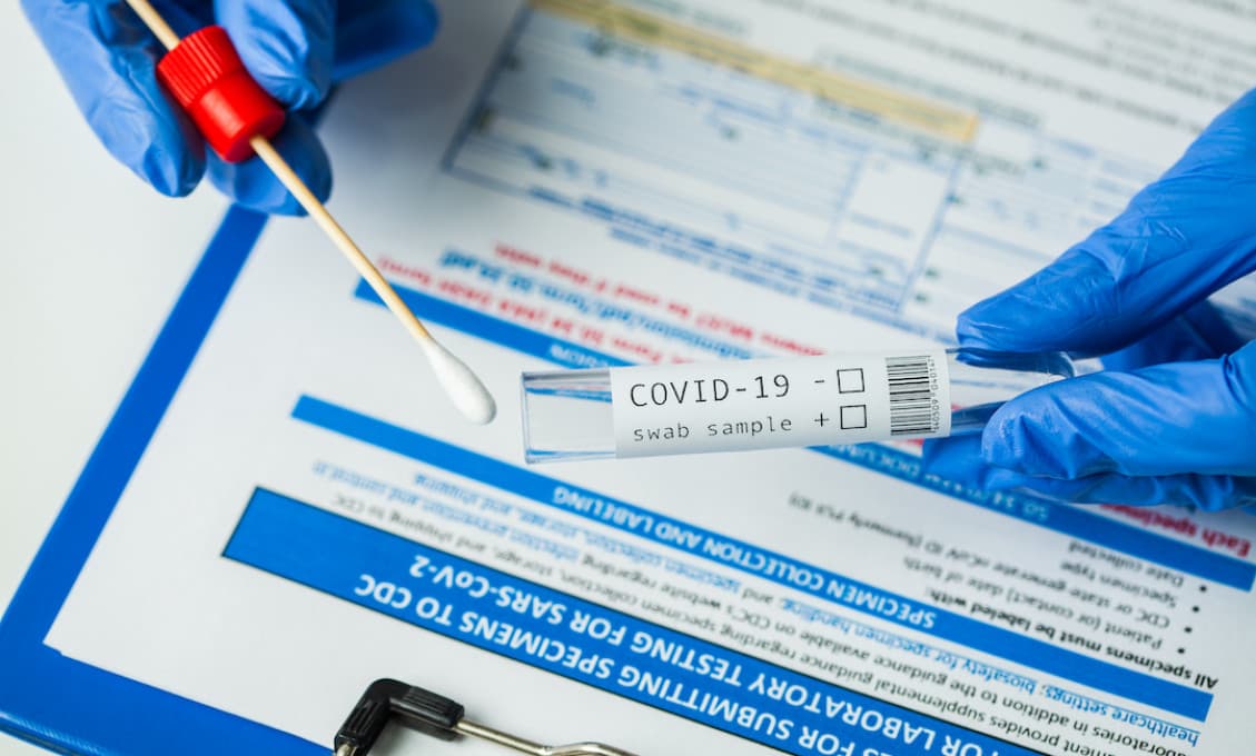 Testy PCR nemajú výpovednú hodnotu! tvrdia svorne WHO aj Švédsky zdravotný úrad