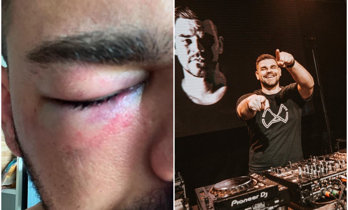 Streľba v Nitre: V ohrození života boli účastníci Farmy aj známy DJ, ten je zranený