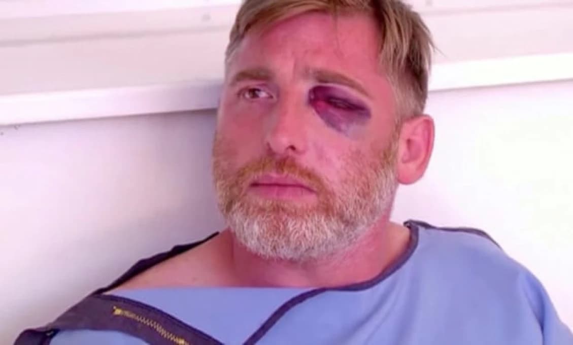 Gruzínsky kameraman zomrel po útoku davu protestujúceho proti pochodu LGBTQ