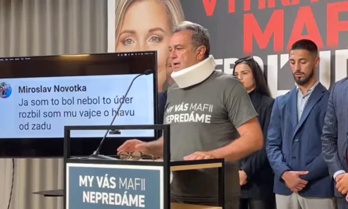 ODPADNEME! Toto sa vám stane, ak dostanete vajcom do hlavy! (VIDEO)