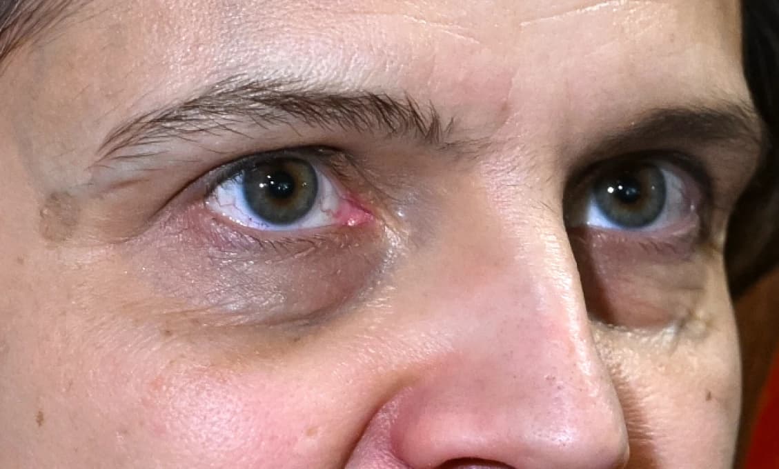 Hlas ľudu: Zachráňte Kolíkovú, potrebuje psychiatra