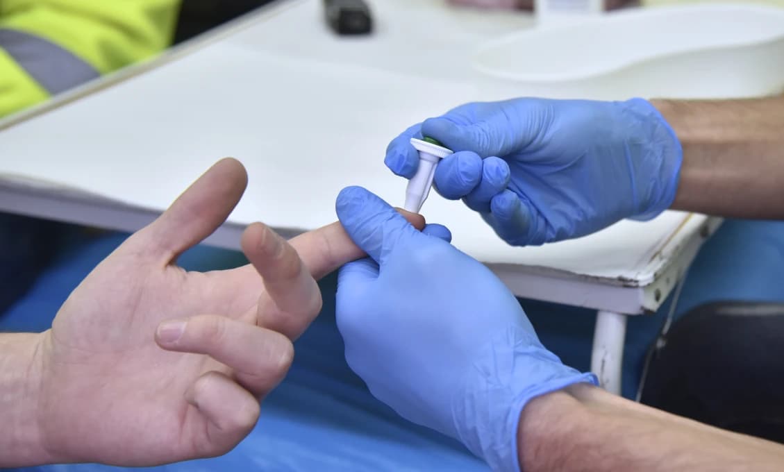 Slovensko sa zapája do Európskeho týždňa testovania na HIV a hepatitídu