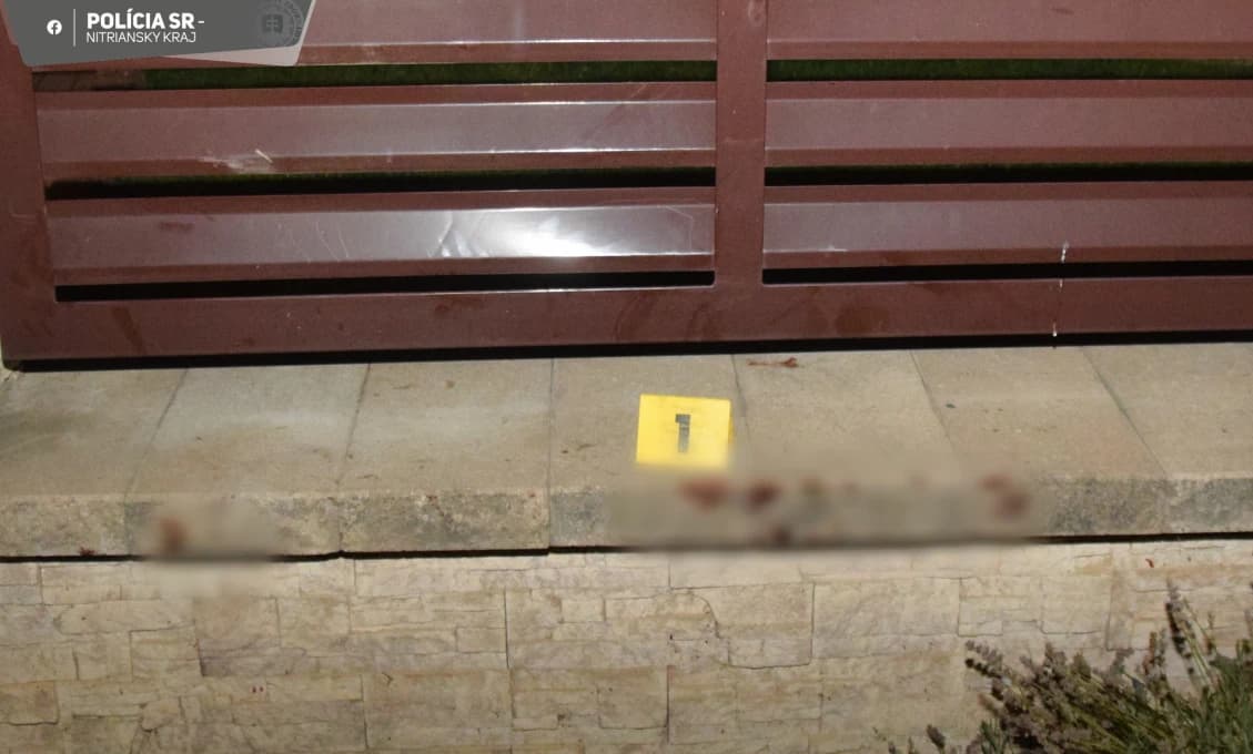 Kričali a prosili o pomoc! Rozzúrený pes napadol tri deti