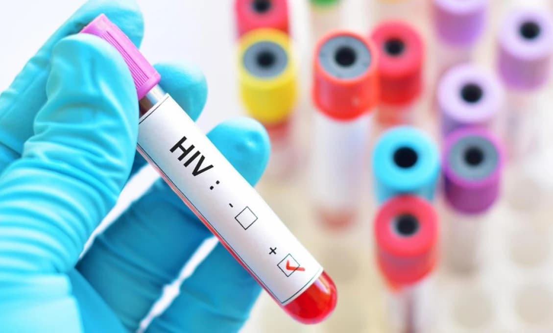 V Česku sprísnia migračný zákon. Dôvodom je nárast AIDS! (VIDEO)