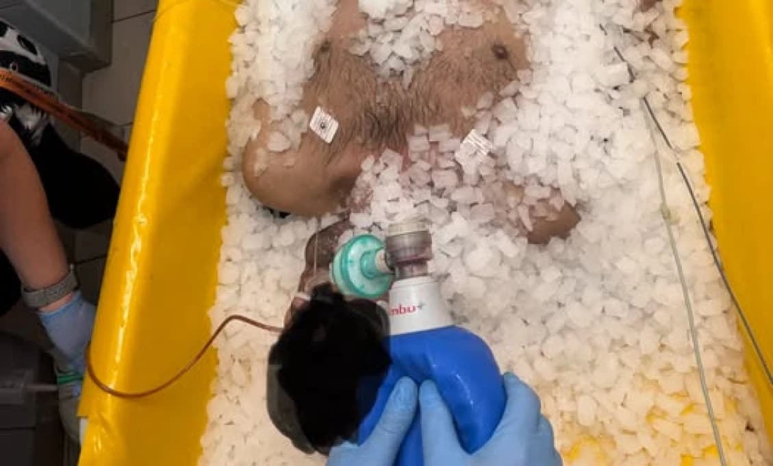 Telo mu horelo zvnútra! Mužovi namerali neuveriteľných 43 °C, lekári v Budapešti museli urobiť niečo, čo bežne nerobia