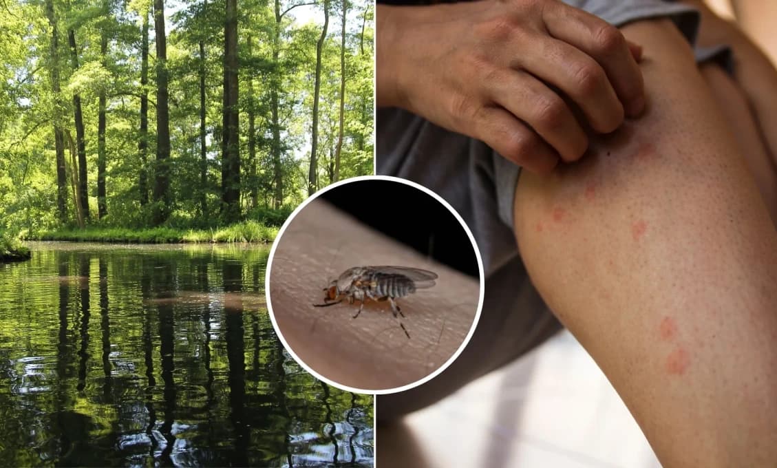 Invázia drobných „krvilačných“ mušiek! Slováci končia po uhryznutí s opuchmi a antibiotikami