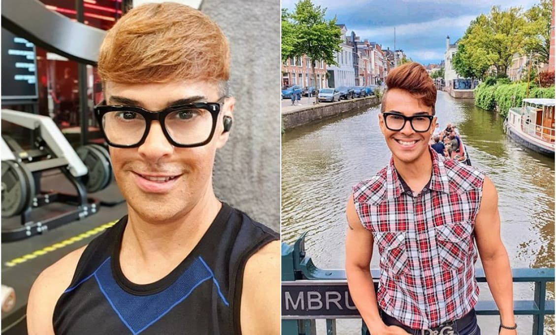Tento „mladík“ má už 53 rokov: Zázrak plastickej chirurgie? Omyl!