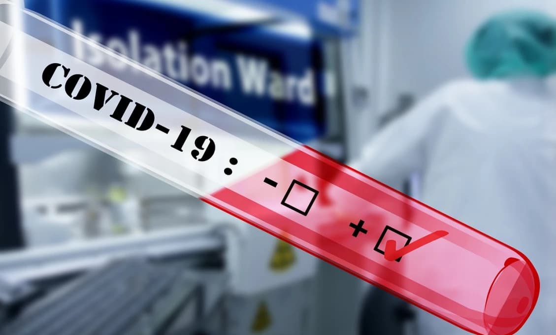 Pozitívny test na koronavírus malo vo firme Agromačaj až 30 ľudí!