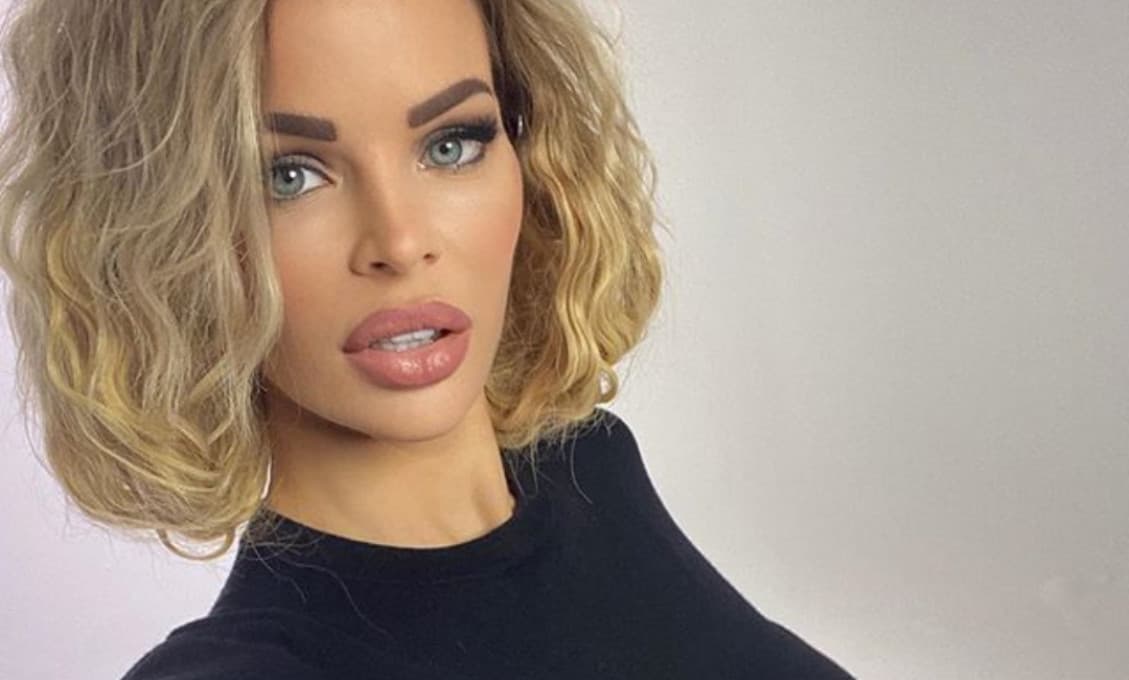 Silvia Kucherenko po zmenšení obrích pier: Takto vyzerá nenamaľovaná! (FOTO)