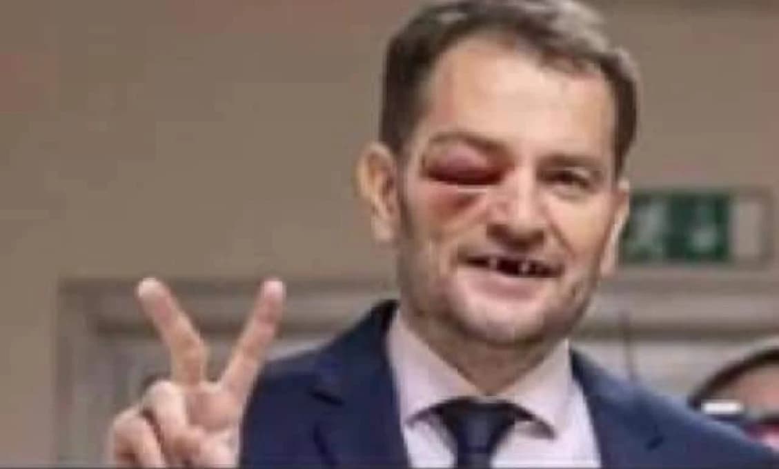 Matovičovci opäť vyrazili! PROVOKOVAŤ NA MÍTING HLASU (VIDEO)