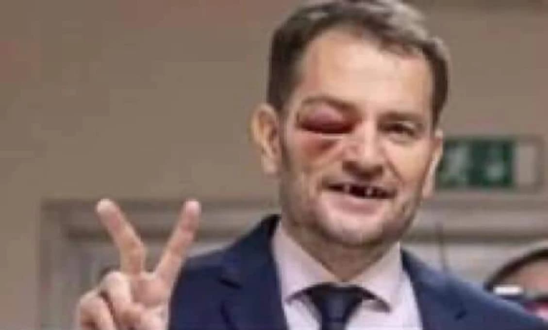 OSTRÁ POTÝČKA v NR SR pred novinármi: Pustili sa do seba Matovič s Mažgútom! (VIDEO)