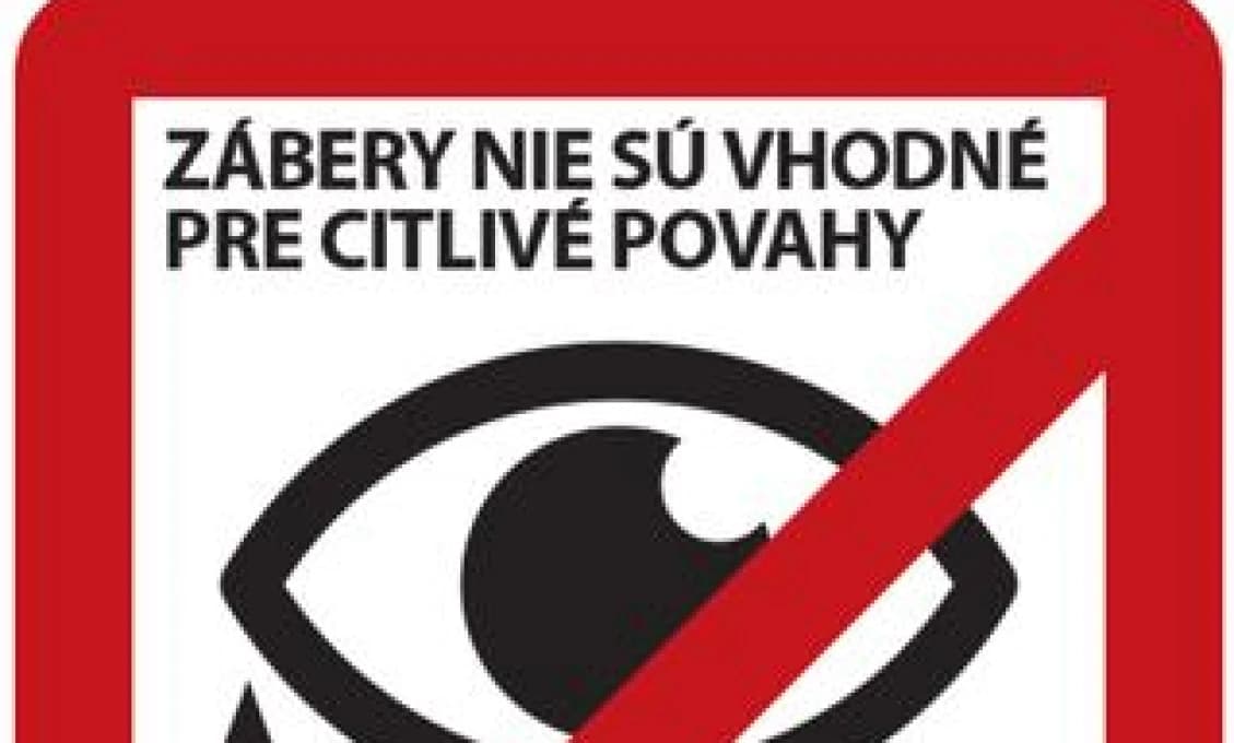 Hrôzostrašný prípad vyšetruje polícia! Zábery nevhodné pre citlivé povahy!