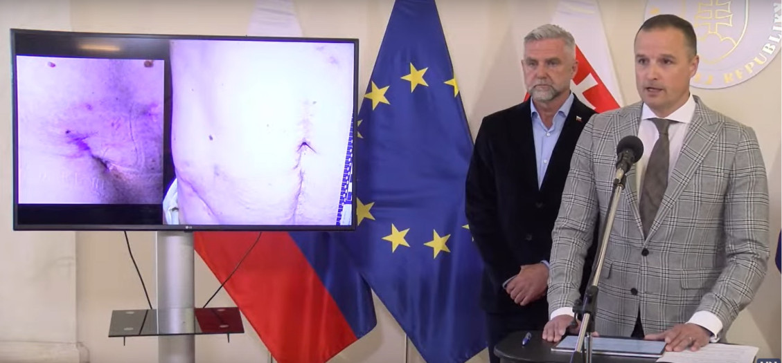 Fotografie prestreleného brucha premiéra Roberta Fica na tlačovej konferencii advokáta Dávida Lindtnera, podppredsedu NR SR Tibora Gašpara a ministra obrany Roberta Kaliňáka
