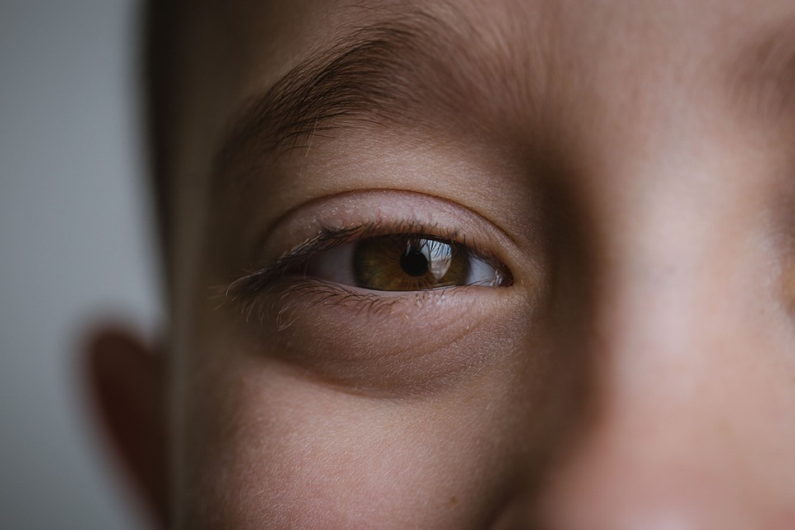 Najrozšírenejšia farba očí na svete je hnedá